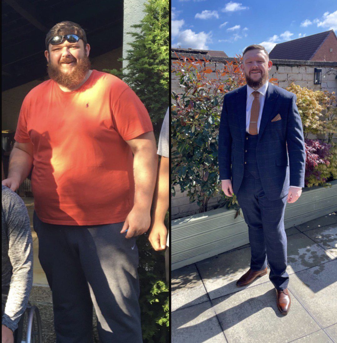 Side-by-side before and after weight loss transformation of a man.